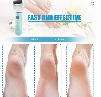 Electric Foot Grinder 🔧🦶 — Cordless Callus Remover, Water-Resistant, Rechargeable (2 Speeds, LED)